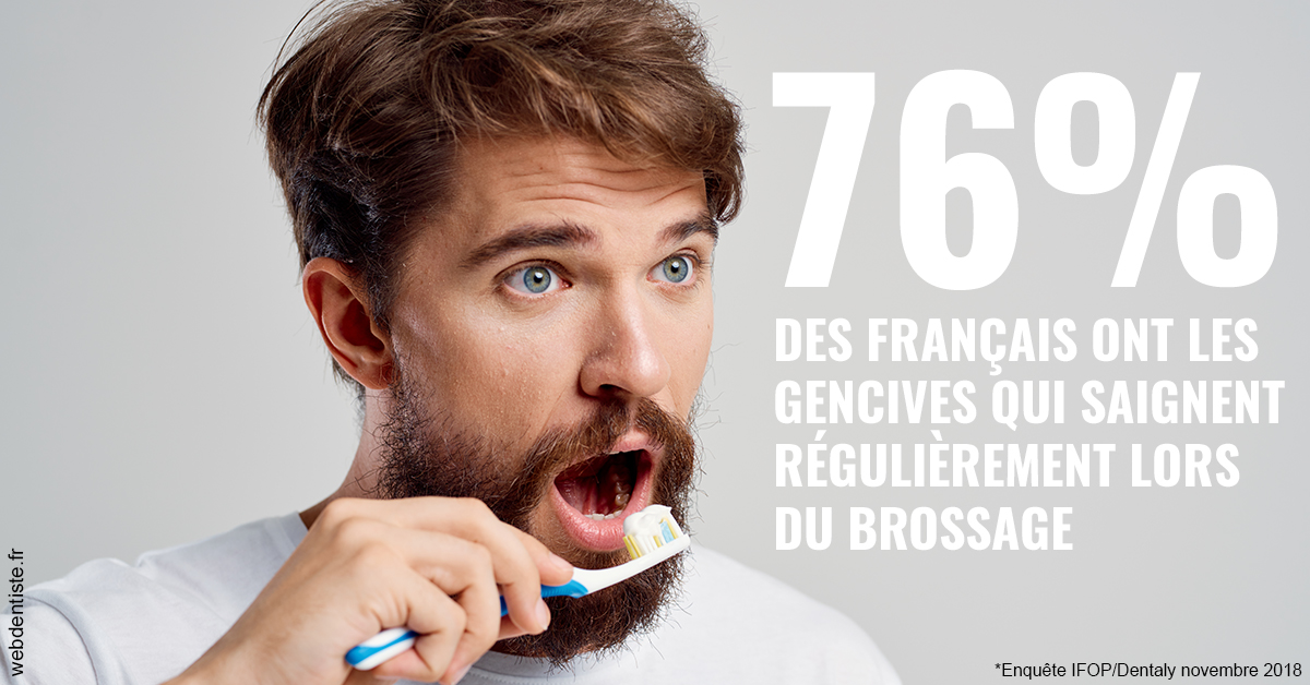 https://selarl-du-docteur-mangez.chirurgiens-dentistes.fr/76% des Français 2