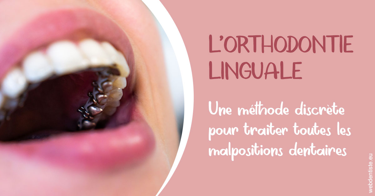 https://selarl-du-docteur-mangez.chirurgiens-dentistes.fr/L'orthodontie linguale 2
