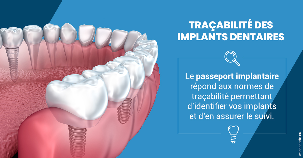 https://selarl-du-docteur-mangez.chirurgiens-dentistes.fr/T2 2023 - Traçabilité des implants 1