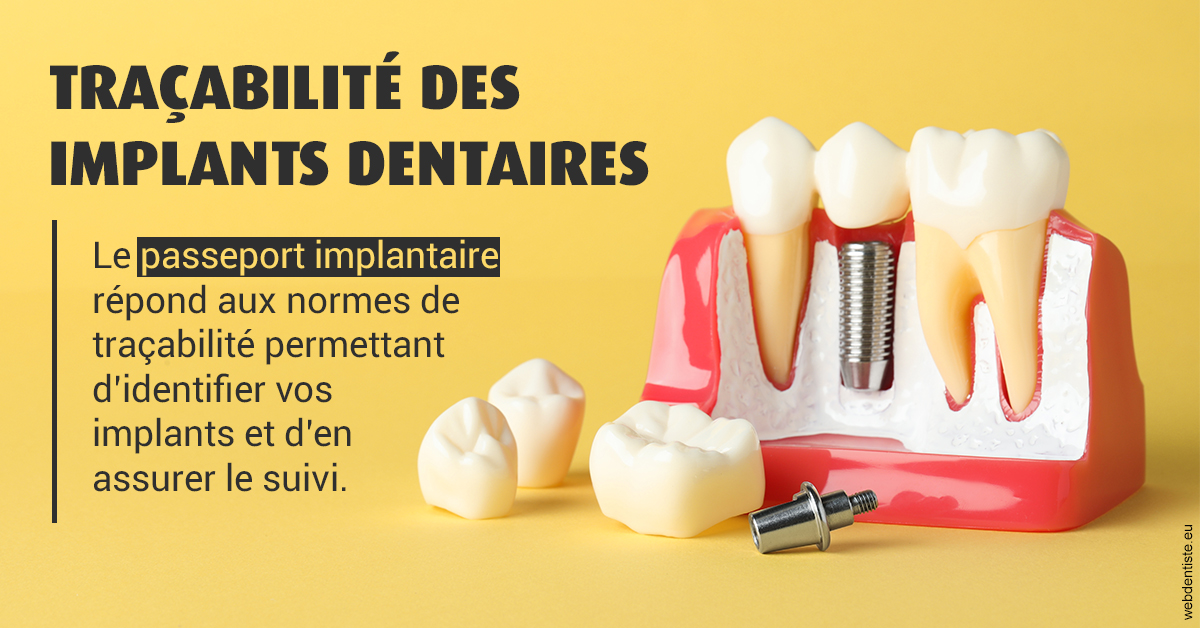 https://selarl-du-docteur-mangez.chirurgiens-dentistes.fr/T2 2023 - Traçabilité des implants 2