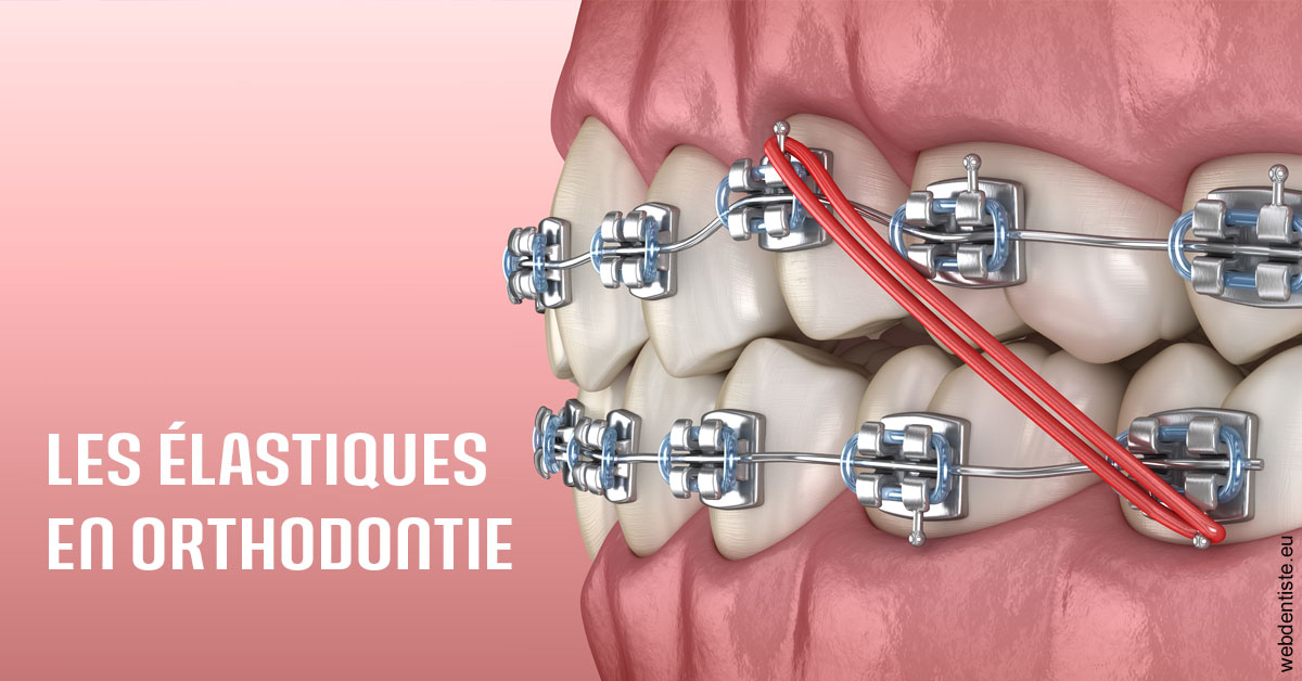 https://selarl-du-docteur-mangez.chirurgiens-dentistes.fr/Elastiques orthodontie 2