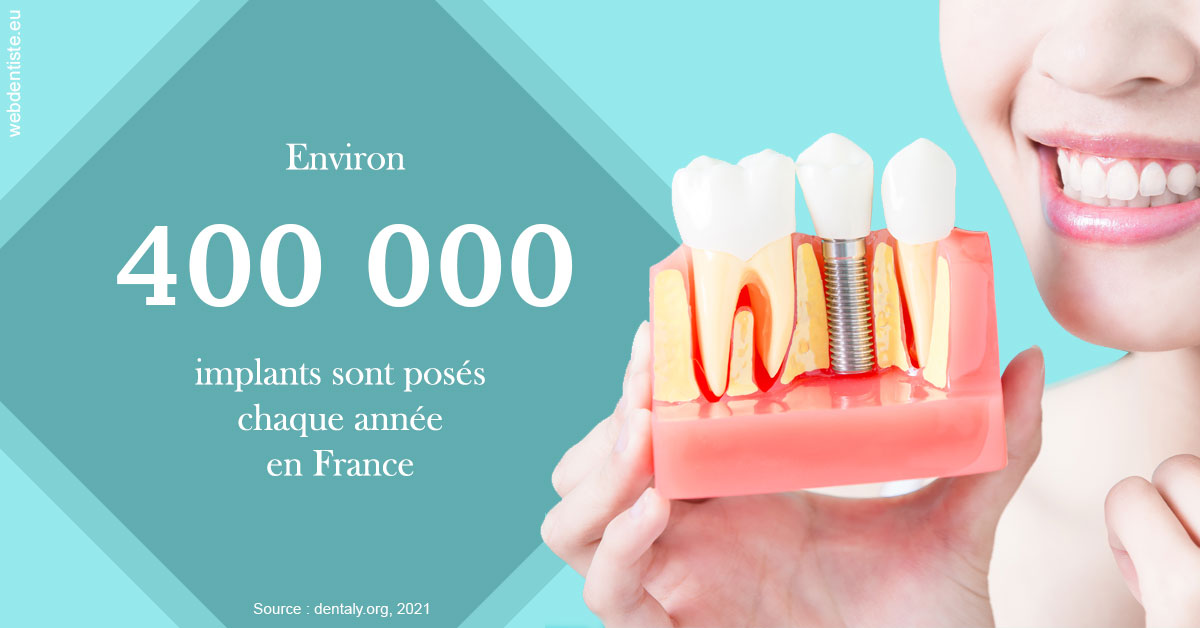 https://selarl-du-docteur-mangez.chirurgiens-dentistes.fr/Pose d'implants en France 2